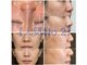 多穏スキンケア(skin care)の写真