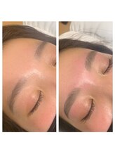 ラ フルール(La Fleur)/ハリウッドブロウリフト