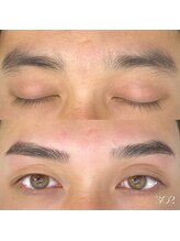 サンマルニ(302)/メンズのハリウッドブロウリフト