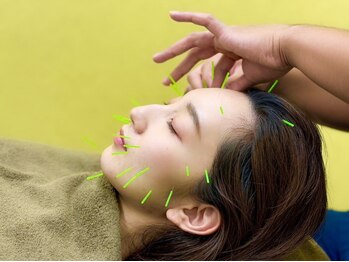 岩槻みんなの鍼灸整骨院/目元・口元のお悩みにアプローチ