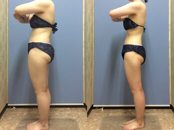 エピア 半田店(Epia)/食べながらダイエット