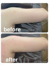 ギンザアール(GINZA R.)/二の腕にアプローチ！