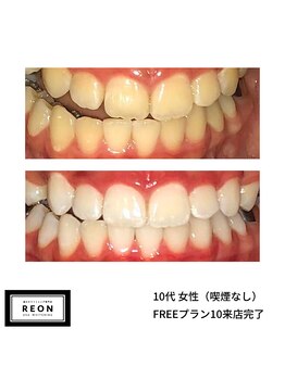 レオン 磐田(REON)/◇ お客様 before＆after ◇