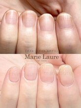 マリーロール 淀屋橋本店(Marie Laure)/自爪育成/深爪矯正/ネイルケア