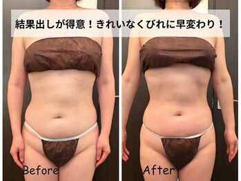 リ ビューティ リバティ(Re:Beauty LIBERTY)の写真/隠す身体卒業しませんか?着たい服着れるようになりたいですよね。バストを落とさず理想のなりたいボディに