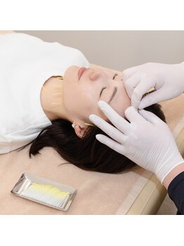 ピアーズ鍼灸整骨院/施術中の様子