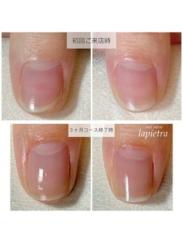 ネイルサロン ラピエトラ(la pietra)/最強のネイルケア３ケ月間コース