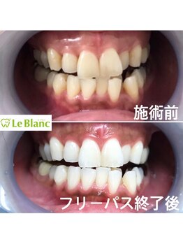 ルブラン 奈良店(Le Blanc)/美人はお口元から!