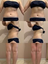 アールハーブデトックス(AR HERB DETOX)/３週間での見た目の変化