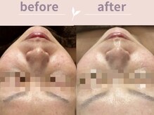 アール(R)/お肌に元気を！