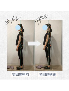 ラクリエ 東加古川院(La Creer)/お客様ビフォーアフター