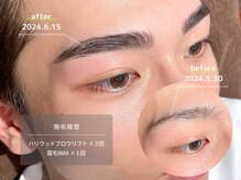 エステマニア(ESUTE MANIA)/施術4回で激変！