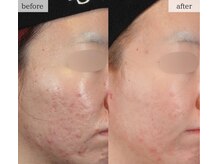 スリリアン 銀座/★お客さまビフォーアフター★