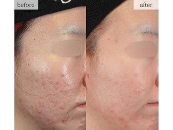 スリリアン 銀座/★お客さまビフォーアフター★