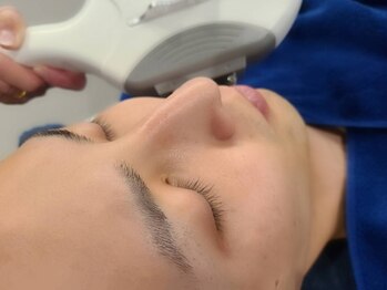 ヘルバ(HERBA)の写真/圧倒的な効果！最短半年で卒業☆頑固な青ひげから顔全体の産毛まで◎清潔感UPのヒゲ脱毛【初回2,980円♪】