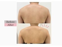 フロリール アザブジュウバン(FlorirAzabujuban)/痩身/肩こり解消/後ろ姿美人