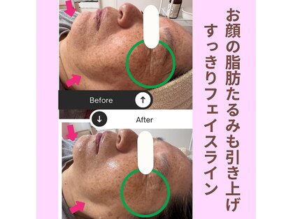 リラ(Lilas)の写真