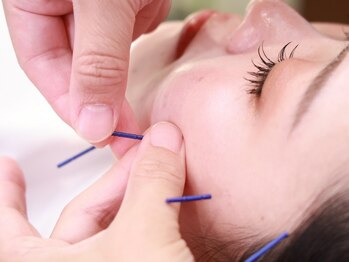 コハルはり灸整骨院(koharuはり灸整骨院)の写真/美容鍼でコラーゲン生成を促進◎肌の弾力UPでシワ,たるみ改善◆5年後の自分に自信を♪今から始める肌ケア