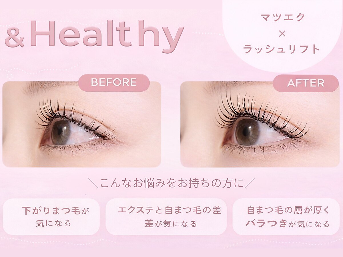 ネイチャンアイ 神楽坂 別館(Nai-Chan Eye)｜ホットペッパービューティー