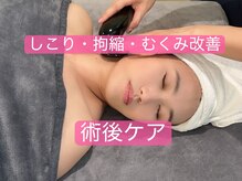 東京ビューティースキンセンター 上野御徒町/【ダウンタイム】お顔集中ケア