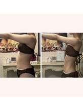 リリー ボヌール(Lily bonheur)/美腕ボディトリートメント