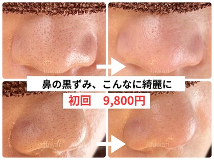 フワリの写真