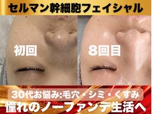 ナーナモエ(na-namoe)の雰囲気（水光肌でくすみ知らずのツヤ肌◎リピート率90%越えの本格美肌！）
