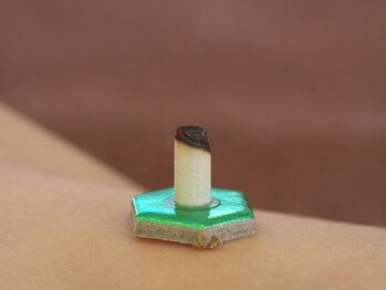 ゆり鍼灸院/お灸施術の台座灸