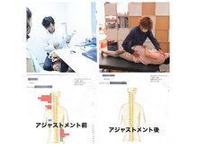 おひさまカイロプラクティックの雰囲気（カウンセリング→検査→矯正→マッサージ→施術後カウンセリング）