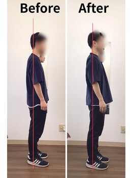 リライフ/Before/After