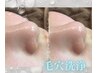 くすみ、毛穴対策に♪《初回限定価格》毛穴洗浄全顔60分コース¥6600→¥5500