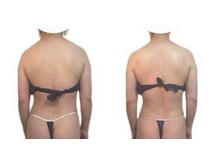 アン シエロン(an cielon)の雰囲気（身体が怠い、痛み浮腫み、更年期、自律神経の乱れ、様々な不調に）