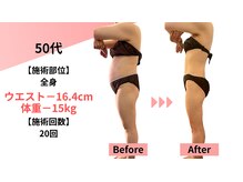 クレビア(Clevia)の雰囲気（全身痩身、小顔も最新マシンと熟練手技で結果出し）