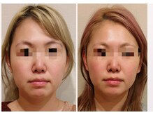 ムーロ(muro.)/コルギ