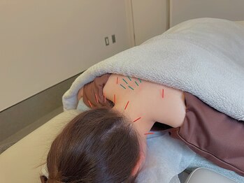 からだ鍼灸院の写真/何をしても効かない肩こり首こりへ!鍼施術で根本にアプローチ!
