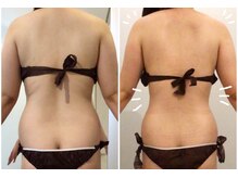 カリーナ(Carina)の雰囲気（before→after!体重マイナス7キロ!ウエストマイナス8センチ！）