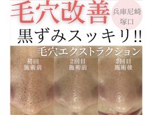 メゾン ド エム(maison de M)の雰囲気（【選ばれる理由がある】毛穴ケア/ニキビケア/60分時短エステ♪）
