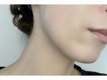 リフレ(Refre)/セルフハーブピーリング