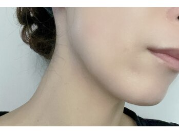 リフレ(Refre)/セルフハーブピーリング