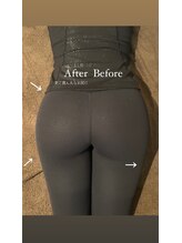 アイラッシュ ルーノ(eyelash Luno)/フェムケア矯正