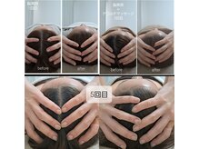 ネマウム(nemaum)/脳美容ドライヘッドスパ