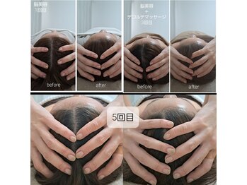 ネマウム(nemaum)/脳美容ドライヘッドスパ