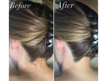 インベスト(INVEST)/Before After