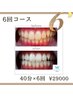 【セット割◎】セルフホワイトニング6セット（1セット：20分×2）￥29000