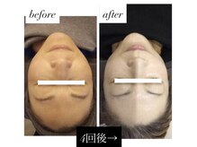 ミミ(mimi)/お肌の土台が完成！