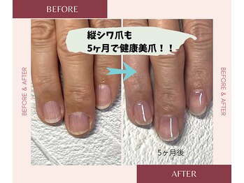 ブルームブルーム(BLOOMブルーム)/縦シワ弱い爪も健康爪に！