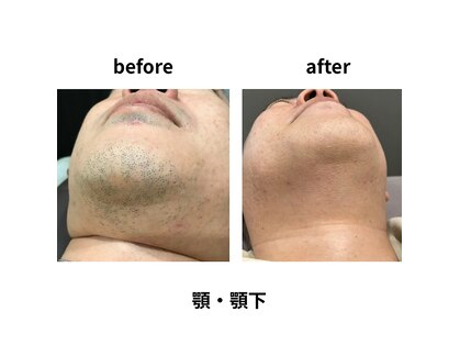 デサフィオ(Desafio.sln)の写真