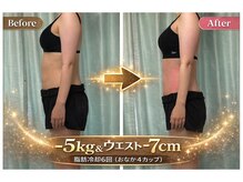 サロンドモモ(SALON de MOMO)の雰囲気（ 見た目が変わる脂肪冷却、始めませんか？）