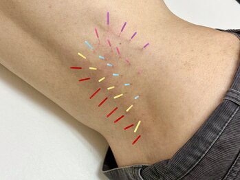 とだ鍼灸院/腰痛