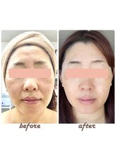 サンボーテ(Sanbeaute)/顔の印象が変わる